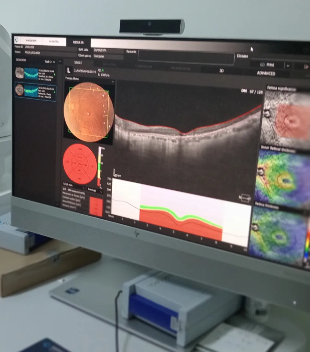 Tomographie en cohérence optique OCT Sousse Tunisie
