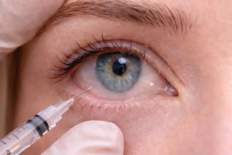 Injection intravitréenne Sousse Tunisie